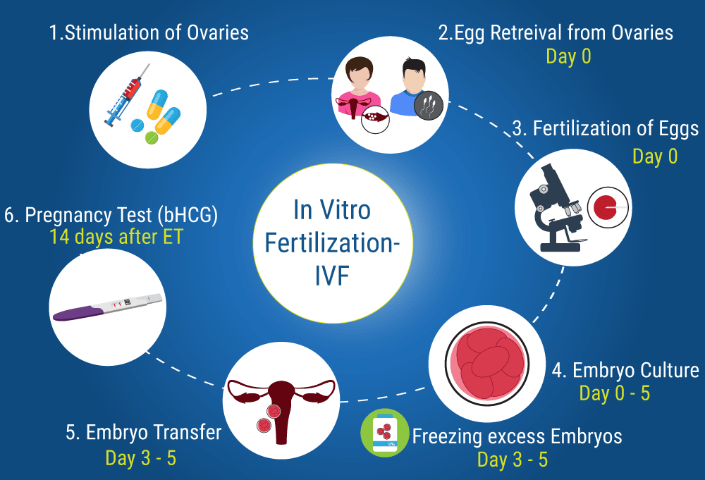 What You Need To Know About In Vitro Fertilization Ivf Process