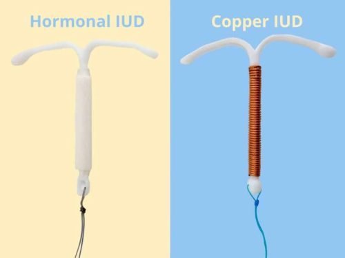 Iud Labeled » Pregnancy & Maternal Health Guide