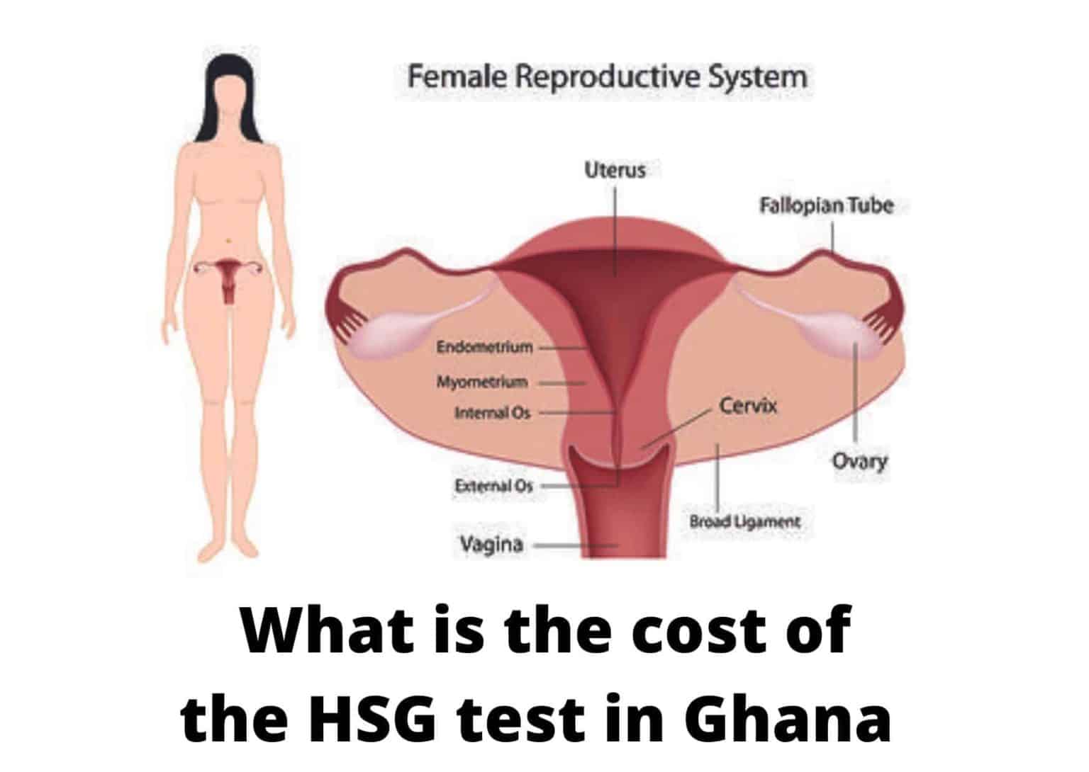 what-is-the-cost-of-hsg-test-in-ghana