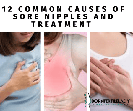 CAUSES OF SORE NIPPLES AND TREATMENT  4