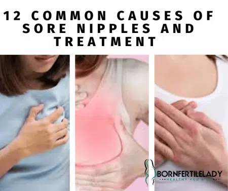 CAUSES OF SORE NIPPLES AND TREATMENT  2