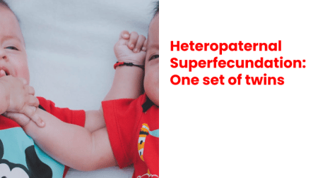 Heteropaternal Superfecundation - One set of twins 2
