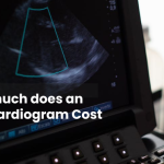 How much does an Echocardiogram Cost 2