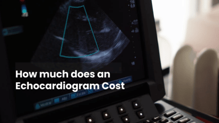 How much does an Echocardiogram Cost 4