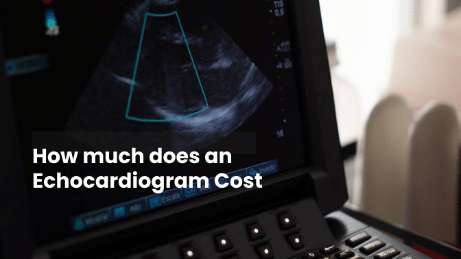 How much does an Echocardiogram Cost 1