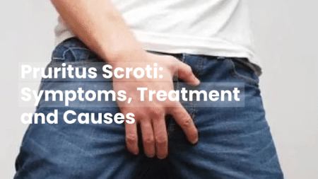Pruritus Scroti: Symptoms, Treatment & Causes 1