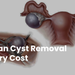 Understanding Ovarian Cyst Removal Surgery Costs 1