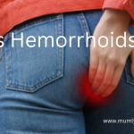 Do Hemorrhoids Kill? 2