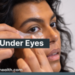Understanding Bags Under Eyes: Causes, Vitamin Deficiency, and Solutions 1