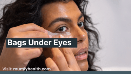 Understanding Bags Under Eyes: Causes, Vitamin Deficiency, and Solutions 2