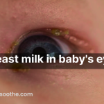 Breast milk in baby's eyes