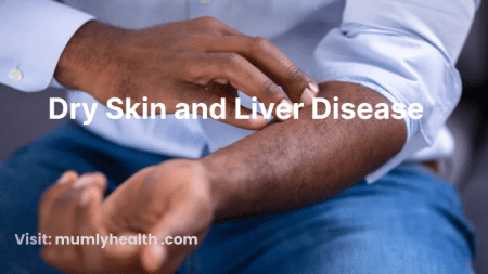 Dry Skin and Liver Disease