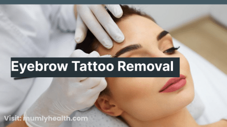 Eyebrow Tattoo Removal