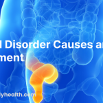 Rectal Disorder Causes and Treatment