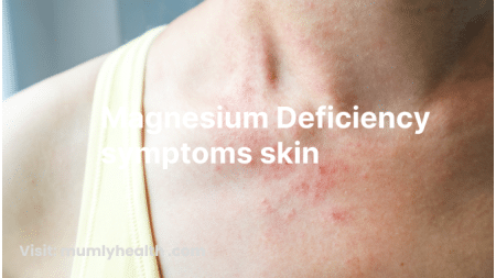 magnesium deficiency symptoms skin