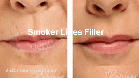 smoker lines filler