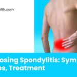 Ankylosing Spondylitis_ Symptoms, Causes, Treatment