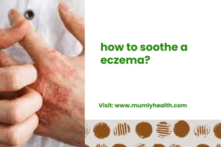 how to soothe a eczema_