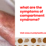 what are the symptoms of compartment syndrome_