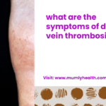 what are the symptoms of deep vein thrombosis_