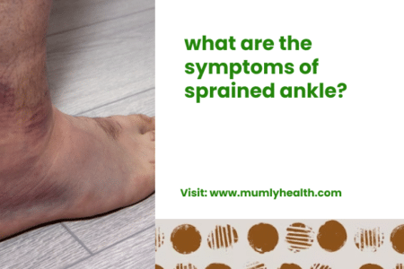 what are the symptoms of sprained ankle_