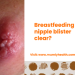 Breastfeeding nipple blister clear_